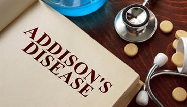 Addison's Disease: New Guideline Details Diagnosis and Treatment Addison's Disease: New Guideline Details Diagnosis and Treatment