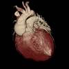 Canagliflozin Reduces Cardiovascular Stress In Older Patients With Type 2 Diabetes Canagliflozin Reduces Cardiovascular Stress In Older Patients With Type 2 Diabetes