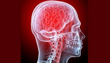 Migraine Management in Female Reproduction Migraine Management in Female Reproduction