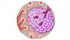 New Point-of-Care C Peptide Test Shows Promise New Point-of-Care C Peptide Test Shows Promise