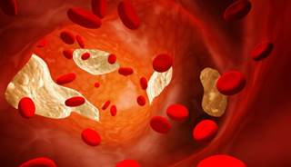 HDL cholesterol may lose its protective effect during menopause. HDL cholesterol may lose its protective effect during menopause.