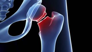 Sitagliptin is not associated with an increased risk for fractures. Sitagliptin is not associated with an increased risk for fractures.