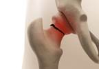 Sleeping Pills and Fracture Risk: Is There A Link? Sleeping Pills and Fracture Risk: Is There A Link?