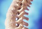 Romosozumab Boosted Bone Strength in Postmenopausal Women Romosozumab Boosted Bone Strength in Postmenopausal Women