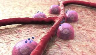 Insulin resistance appeared to be more frequent in patients with a modified disease activity score 28 joints without acute-phase reactants (mDAS28-SE) of >5.1 compared with those who had lower scores. Insulin resistance appeared to be more frequent in patients with a modified disease activity score 28 joints without acute-phase reactants (mDAS28-SE) of >5.1 compared with those who had lower scores.