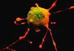 Pheochromocytoma and Paraganglioma: New Clinical Guidelines From the Endocrine Society Pheochromocytoma and Paraganglioma: New Clinical Guidelines From the Endocrine Society