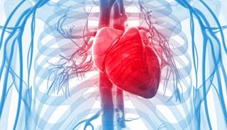 Metabolic Syndrome May Up Mortality Risk After Angiography Metabolic Syndrome May Up Mortality Risk After Angiography
