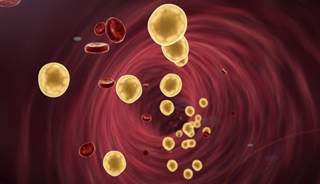 Alirocumab significantly decreased severe cardiovascular risks in patients with acute coronary syndrome. Alirocumab significantly decreased severe cardiovascular risks in patients with acute coronary syndrome.