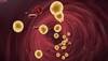 Cholesterol drug may lower risk for death and cardiovascular events Cholesterol drug may lower risk for death and cardiovascular events