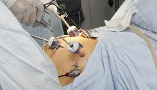 Weighing Benefits, Risks of Gastric Bypass vs. Gastric Banding Weighing Benefits, Risks of Gastric Bypass vs. Gastric Banding