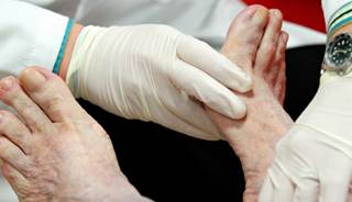 Hyperbaric oxygen therapy does not facilitate wound healing or reduce indications for amputation. Hyperbaric oxygen therapy does not facilitate wound healing or reduce indications for amputation.