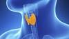 Study Identifies Risk Estimates for Occult Nodal Disease After Thyroidectomy Study Identifies Risk Estimates for Occult Nodal Disease After Thyroidectomy