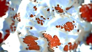 Visceral Fat Linked to Cardiometabolic Risk Visceral Fat Linked to Cardiometabolic Risk