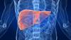 Case Study: Hepatitis C Therapy Improved Glycemic Control in Diabetes Case Study: Hepatitis C Therapy Improved Glycemic Control in Diabetes
