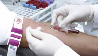 HbA1c Predicts Incident Diabetes HbA1c Predicts Incident Diabetes