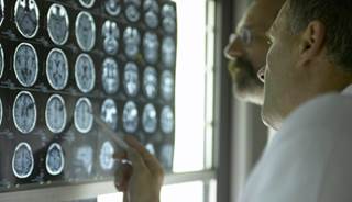 How Does Type 1 Diabetes Affect Children’s Brains? How Does Type 1 Diabetes Affect Children’s Brains?