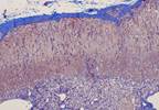 Cushing's Syndrome Etiology Affects Adrenal Function Recovery Cushing's Syndrome Etiology Affects Adrenal Function Recovery