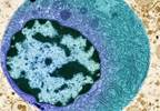 New Nomogram Predicts Death, Recurrence Risk in Papillary Thyroid Cancer New Nomogram Predicts Death, Recurrence Risk in Papillary Thyroid Cancer