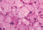 New Compound May Be Able to 'Brown' White Fat New Compound May Be Able to 'Brown' White Fat