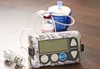 A Call for Improved Surveillance of Insulin Pump Therapy A Call for Improved Surveillance of Insulin Pump Therapy