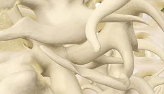 Growth hormone increased BMD and decreased fractures in older women. Growth hormone increased BMD and decreased fractures in older women.