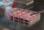 Induced Pluripotent Stem Cells: New Tool for Studying Insulin Resistance Induced Pluripotent Stem Cells: New Tool for Studying Insulin Resistance