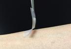 'Smart' Insulin Patch Shows Promise for Diabetes 'Smart' Insulin Patch Shows Promise for Diabetes