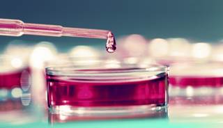 A nonviral gene therapy may relieve symptoms of painful diabetic neuropathy. A nonviral gene therapy may relieve symptoms of painful diabetic neuropathy.