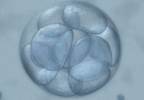 Elective Single Embryo Transfer May Be Less Successful for in Ethnic Minority Groups Elective Single Embryo Transfer May Be Less Successful for in Ethnic Minority Groups