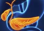DPP-4I Not Tied to Increased Risk of Acute Pancreatitis in Seniors DPP-4I Not Tied to Increased Risk of Acute Pancreatitis in Seniors