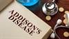 Addison's Disease: New Guideline Details Diagnosis and Treatment Addison's Disease: New Guideline Details Diagnosis and Treatment