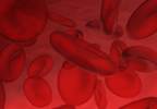 Testosterone Undecanoate May Reduce Anemia in Men With Hypogonadism Testosterone Undecanoate May Reduce Anemia in Men With Hypogonadism