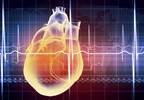 EXAMINE Trial Post-Hoc Analysis: Prior CV Event Increased Mortality Risk in Type 2 Diabetes EXAMINE Trial Post-Hoc Analysis: Prior CV Event Increased Mortality Risk in Type 2 Diabetes