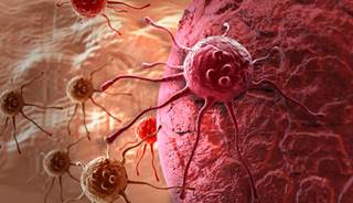 Risk for cancer may depend on the duration of type 1 diabetes. Risk for cancer may depend on the duration of type 1 diabetes.