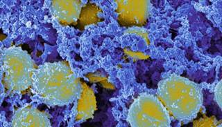 Patients with diabetes at heightened risk for S. aureus bacteremia. Patients with diabetes at heightened risk for S. aureus bacteremia.