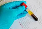 TSH Lab Results With Brand vs Generic Levothyroxine TSH Lab Results With Brand vs Generic Levothyroxine