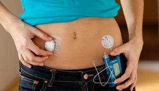 Insulin requirements may vary more than daytime requirements in patients with type 1 diabetes. Insulin requirements may vary more than daytime requirements in patients with type 1 diabetes.