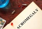 Acromegaly Diagnosis Delayed in Elderly Woman Acromegaly Diagnosis Delayed in Elderly Woman