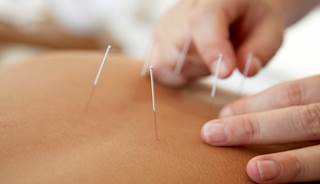 Acupuncture may reduce frequency of vasomotor symptoms. Acupuncture may reduce frequency of vasomotor symptoms.