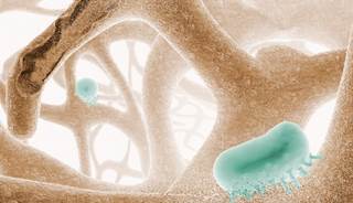 Significant bone resorption was noted in mice who received SSRIs during lactation. Significant bone resorption was noted in mice who received SSRIs during lactation.