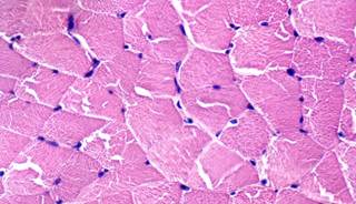 Animal study shows importance of crosstalk between bone and muscle. Animal study shows importance of crosstalk between bone and muscle.