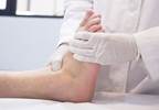 Increased Burden of Care With Diabetic Foot Ulcers, Infections Increased Burden of Care With Diabetic Foot Ulcers, Infections