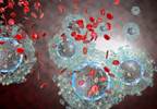 Bone Health Adversely Affected by HIV Infection With T-Cell Activation Bone Health Adversely Affected by HIV Infection With T-Cell Activation