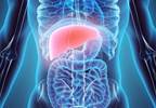Nonalcoholic Fatty Liver Disease Risk Higher With Hypothyroidism Nonalcoholic Fatty Liver Disease Risk Higher With Hypothyroidism