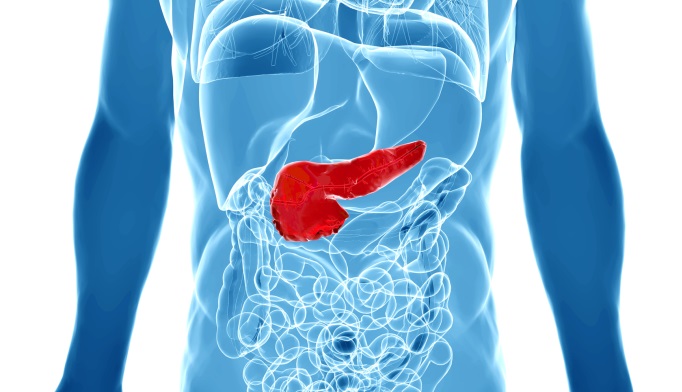 Fatty Pancreas Not Associated With Type 2 Diabetes