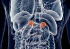 Endocrine Society Updates Congenital Adrenal Hyperplasia Clinical Practice Guidelines Endocrine Society Updates Congenital Adrenal Hyperplasia Clinical Practice Guidelines