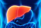 Topline Data Announced for Selonsertib in Patients With Compensated Cirrhosis Due to NASH Topline Data Announced for Selonsertib in Patients With Compensated Cirrhosis Due to NASH