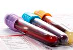 Harmonized Testosterone Reference Ranges Established for Men Harmonized Testosterone Reference Ranges Established for Men
