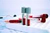 Tuberculosis Diagnosis: Improved Blood Test by Qiagen to Hit Shelves Tuberculosis Diagnosis: Improved Blood Test by Qiagen to Hit Shelves