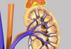 Growth Hormone Plus Aromatase Inhibitor in Congenital Adrenal Hyperplasia Growth Hormone Plus Aromatase Inhibitor in Congenital Adrenal Hyperplasia